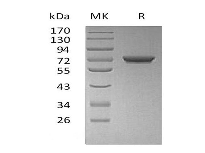 Recombinant Human GALNT7 Protein (His Tag)