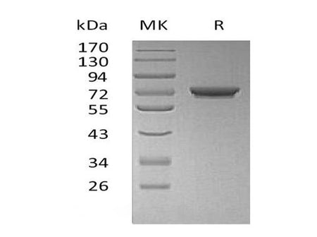Recombinant Human GALNT7 Protein (His Tag)