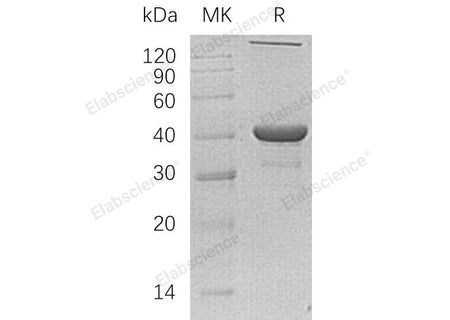 Recombinant Human NANS/SAS Protein (His Tag)