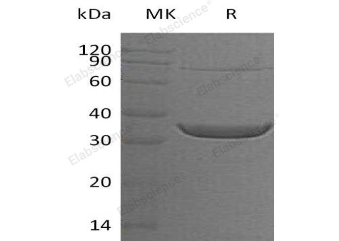 Recombinant Human ACY3 Protein (His Tag)
