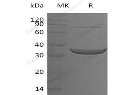 Recombinant Human ACY3 Protein (His Tag)