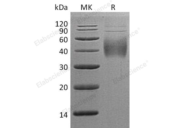 Recombinant Human 2B4/CD244 Protein (His Tag)