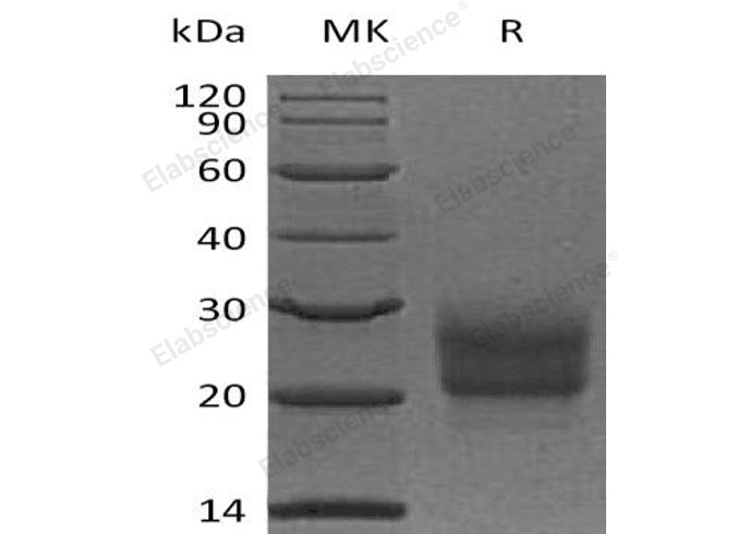 Recombinant Human NCR3/NKp30 Protein (His Tag)