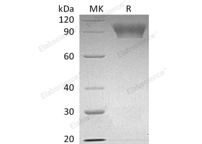 Recombinant Human NLGN4X Protein (His Tag)