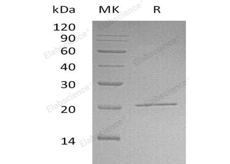 Recombinant Human NIP7/KD93 Protein (His Tag)