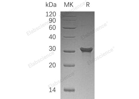Recombinant Human PAFAH1B2/PAFAHB Protein (His Tag)