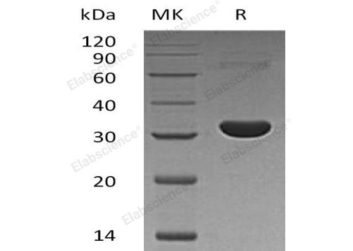 Recombinant Human PBLD/MAWBP Protein (His Tag)