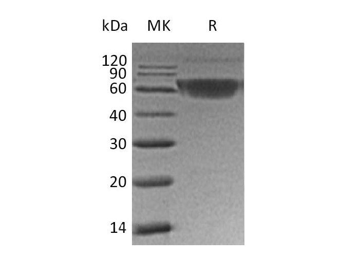 Recombinant Human PD-1/PDCD1 Protein (mFc Tag)(Active)