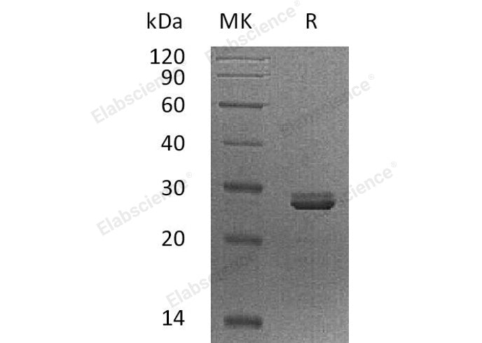 Recombinant Human PDCD10/TFAR15 Protein