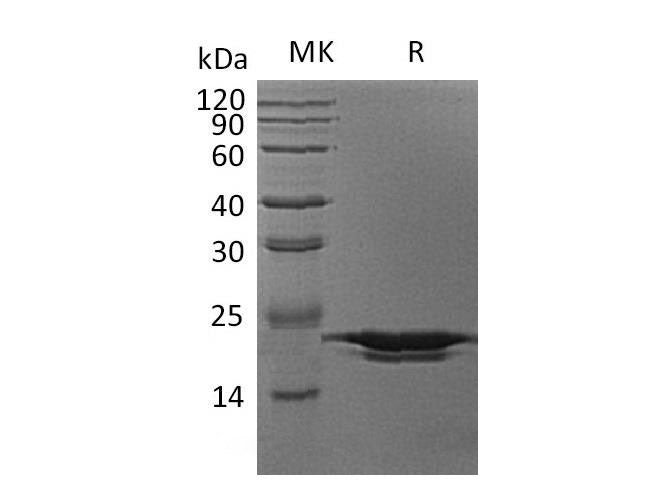 Recombinant Human PPIH Protein (His Tag)