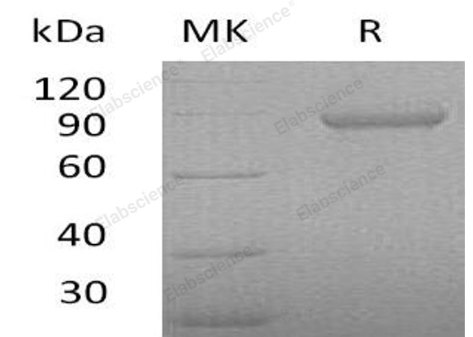 Recombinant Human Periostin/OSF-2 Protein (His Tag)