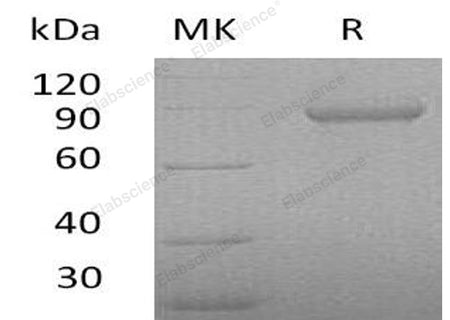 Recombinant Human Periostin/OSF-2 Protein (His Tag)