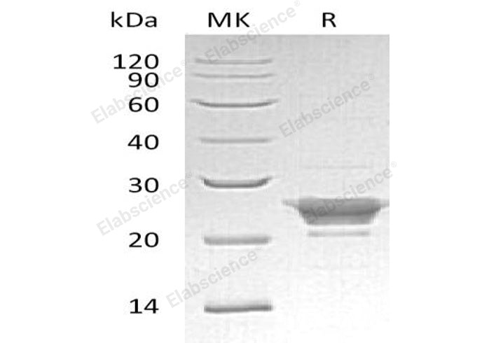 Recombinant Human Peroxiredoxin-3/PRDX3 Protein