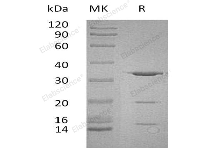Recombinant Human PITPNA Protein (His Tag)