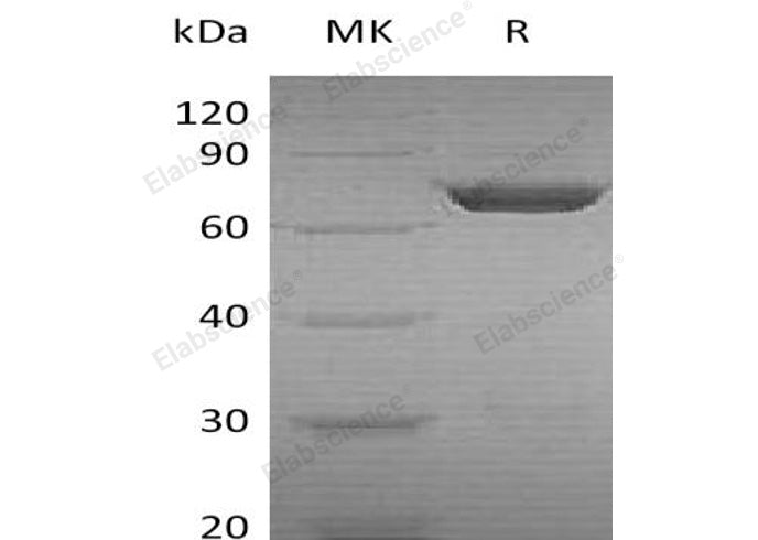 Recombinant Human PGM2 Protein (His Tag) 