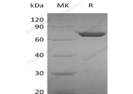 Recombinant Human PGM2 Protein (His Tag) 