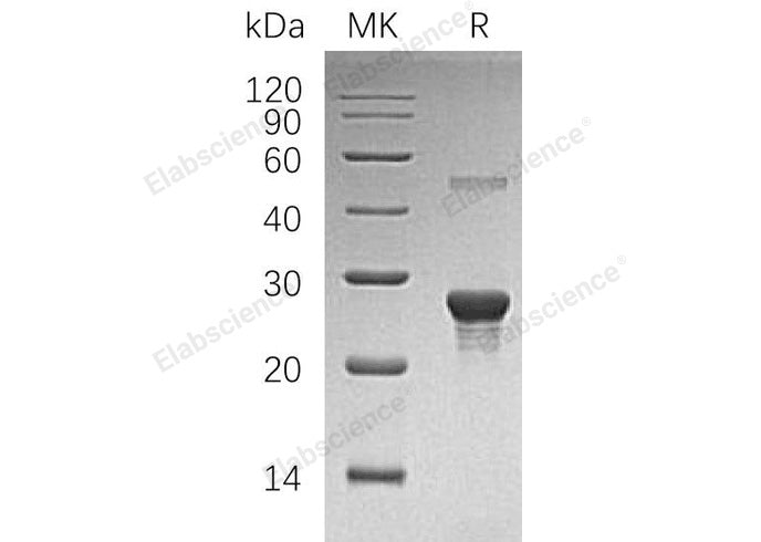 Recombinant Human PPCDC Protein (His Tag)