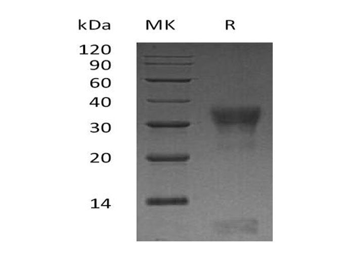 Recombinant Human PIK3IP1 Protein (His Tag) 
