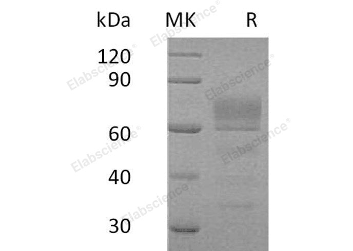 Recombinant Human Podoplanin/PDPN Protein (Fc Tag)