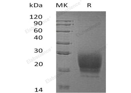 Recombinant Human PRND Protein (His Tag)