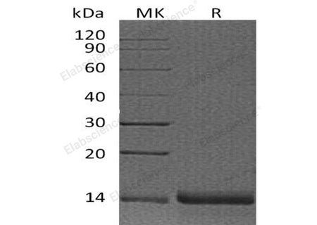 Recombinant Human Profilin-2/PFN2 Protein