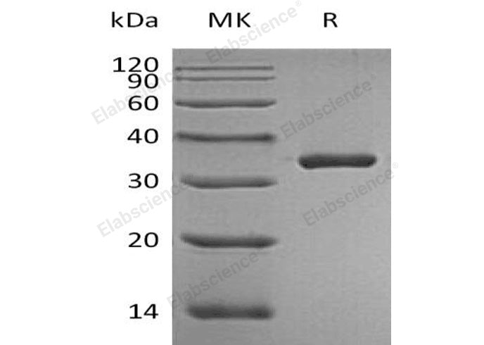 Recombinant Human PSA/KLK3 Protein (aa 18-261, His Tag)