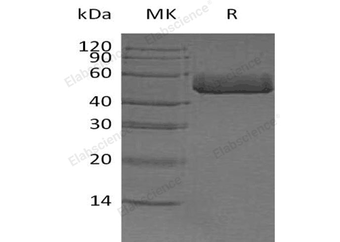 Recombinant Human Prostatic Acid Phosphatase/ACPP Protein (His Tag)