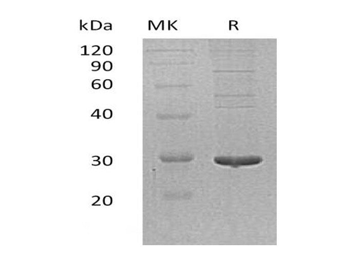 Recombinant Human PDIA5 Protein (His Tag)