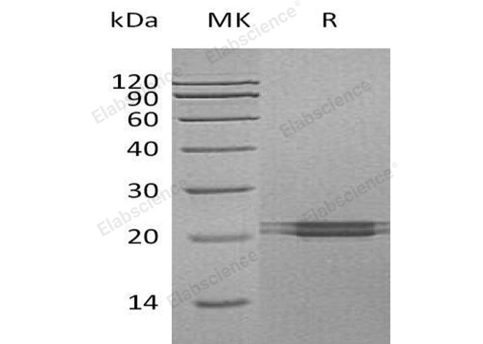 Recombinant Human FAM3C Protein (His Tag)