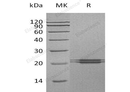 Recombinant Human FAM3C Protein (His Tag)