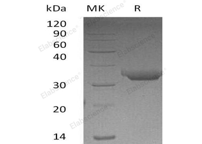 Recombinant Human Proteinase 3/PRTN3 Protein (His Tag)