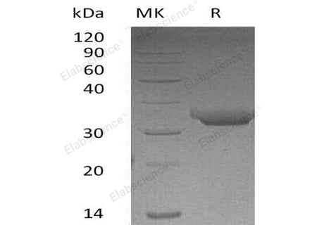 Recombinant Human Proteinase 3/PRTN3 Protein (His Tag)