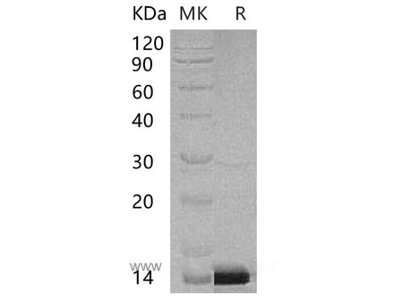 Recombinant Human PCBD1 Protein (His Tag)