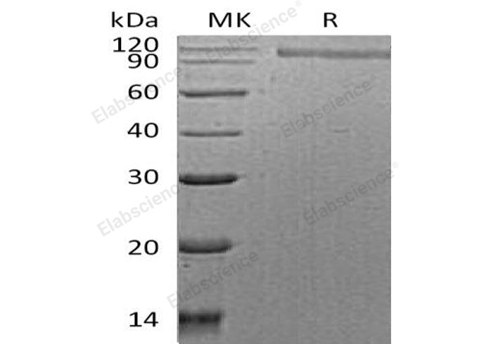 Recombinant Human HER2/ErbB2 Protein (His Tag)
