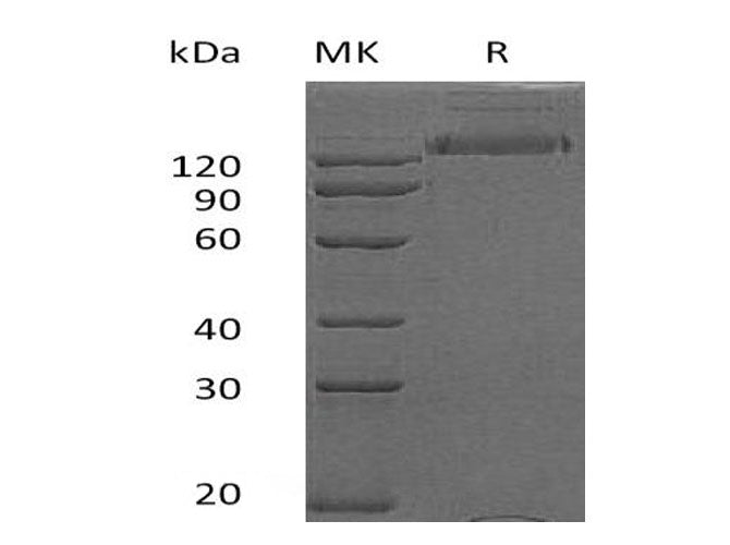 Recombinant Human HER2/ErbB2 Protein (Fc Tag)