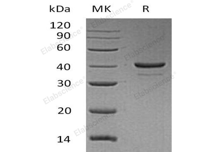 Recombinant Human Resistin Protein (aa 19-108, Fc Tag)