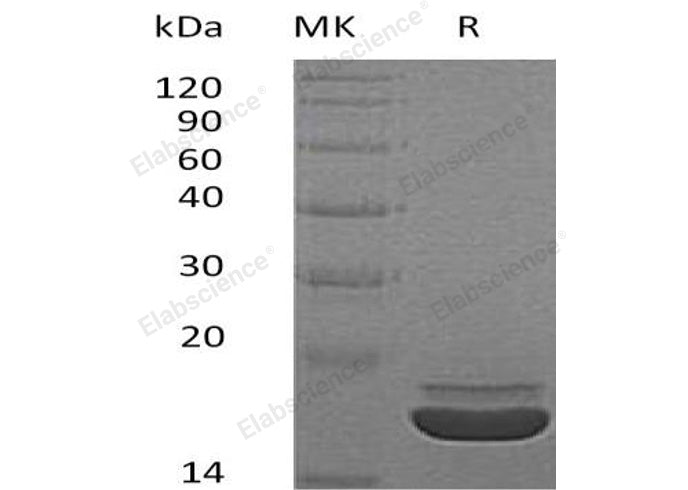 Recombinant Human RARRES2/TIG2 Protein (His Tag)