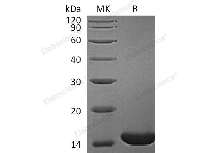 Recombinant Human Retinol-Binding Protein 1/RBP1 Protein