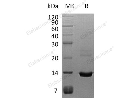 Recombinant Human S100A8 Protein (His Tag)