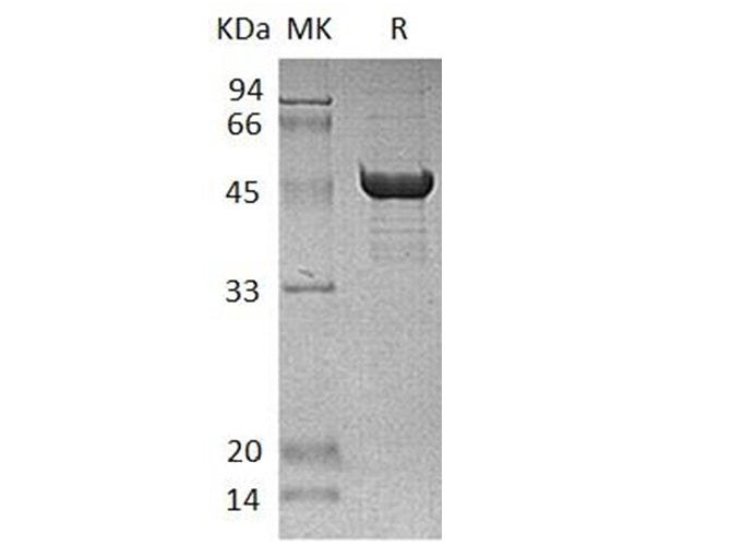 Recombinant Human SCLY Protein (His Tag)