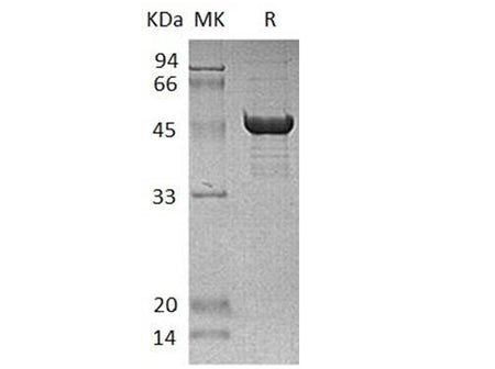 Recombinant Human SCLY Protein (His Tag)