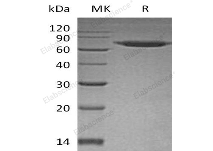 Recombinant Human SENP8 Protein (His Tag)