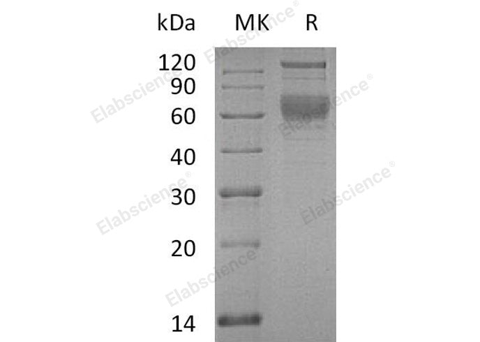 Recombinant Human SerpinA4/SERPINA4 Protein (His Tag)