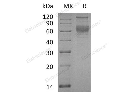 Recombinant Human SerpinA4/SERPINA4 Protein (His Tag)