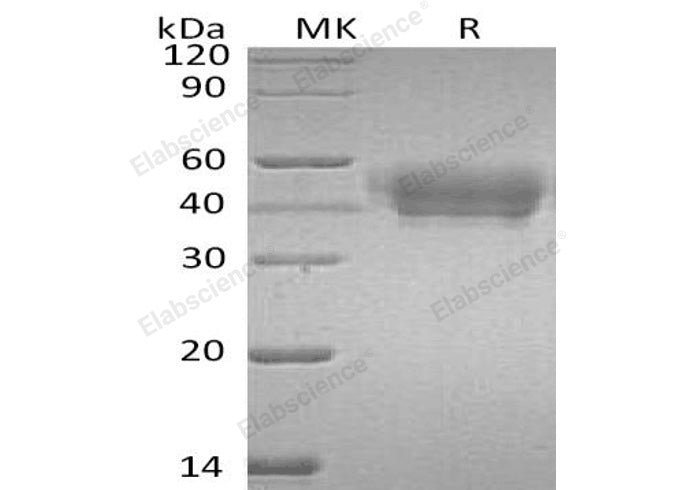 Recombinant Human SerpinA5/SERPINA5 Protein (His Tag)