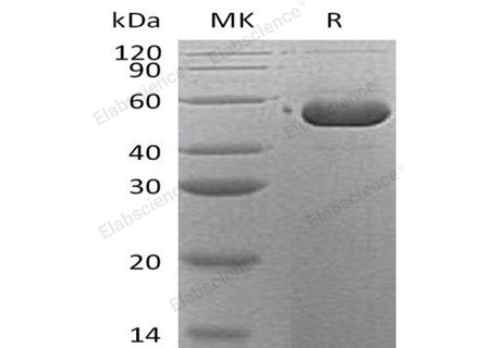 Recombinant Human SerpinB12/SERPINB12 Protein (His Tag)