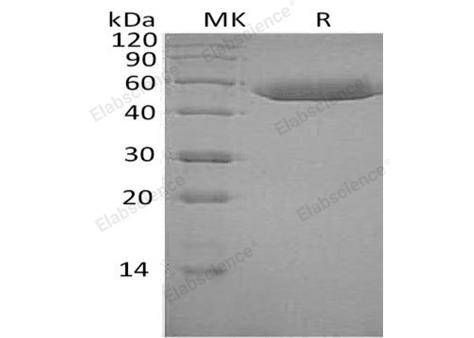 Recombinant Human SerpinF1/PEDF Protein (His Tag)