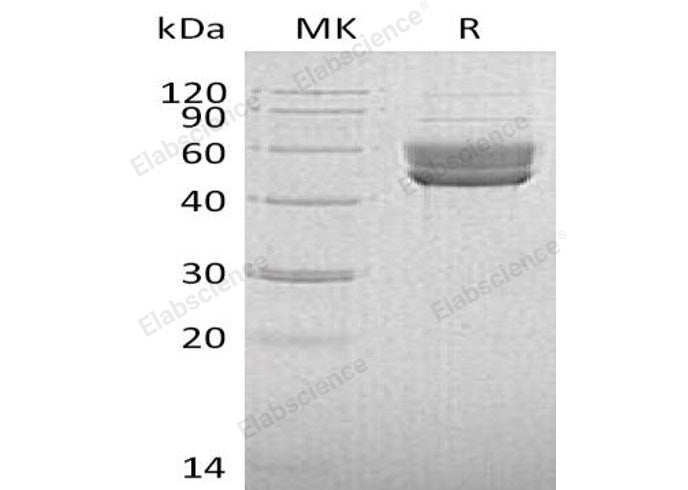 Recombinant Human SerpinI2 Protein (His Tag)