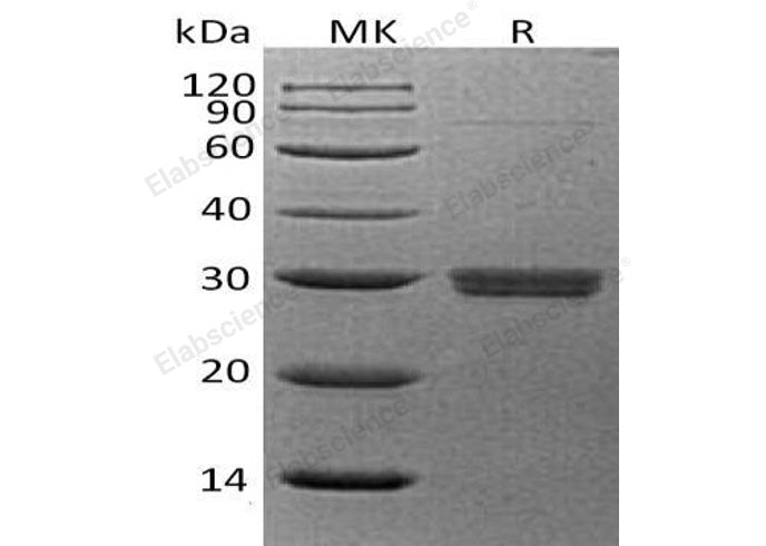 Recombinant Human APCS/SAP Protein (His Tag)