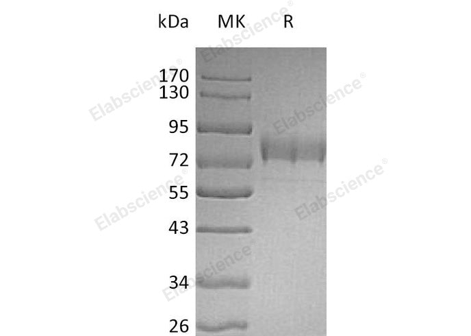 Recombinant Human SIGLEC3/CD33 Protein (Fc & His Tag)